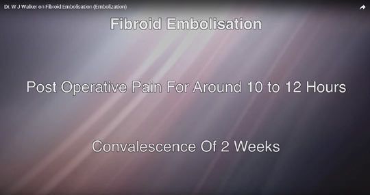 Dr. Walker uterine fibroids