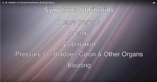 Dr. Walker uterine fibroids